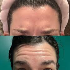 The Vita A Retinal Shot Tightening Booster | 0.1% Retinal, 3% Matryxyl 15ml