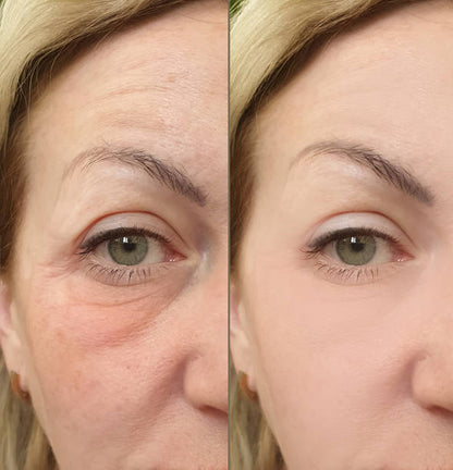 The Vita A Retinal Shot Tightening Booster | 0.1% Retinal, 3% Matryxyl 15ml